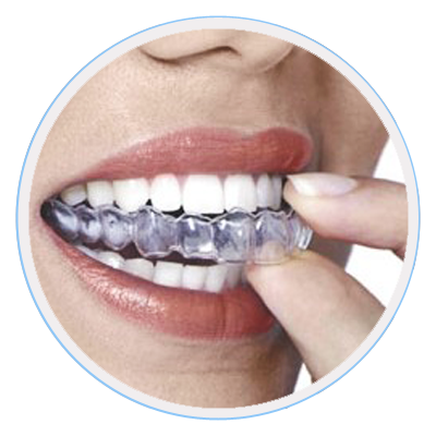 Invisalign-Melbourne