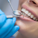 dental-implants-blog-1